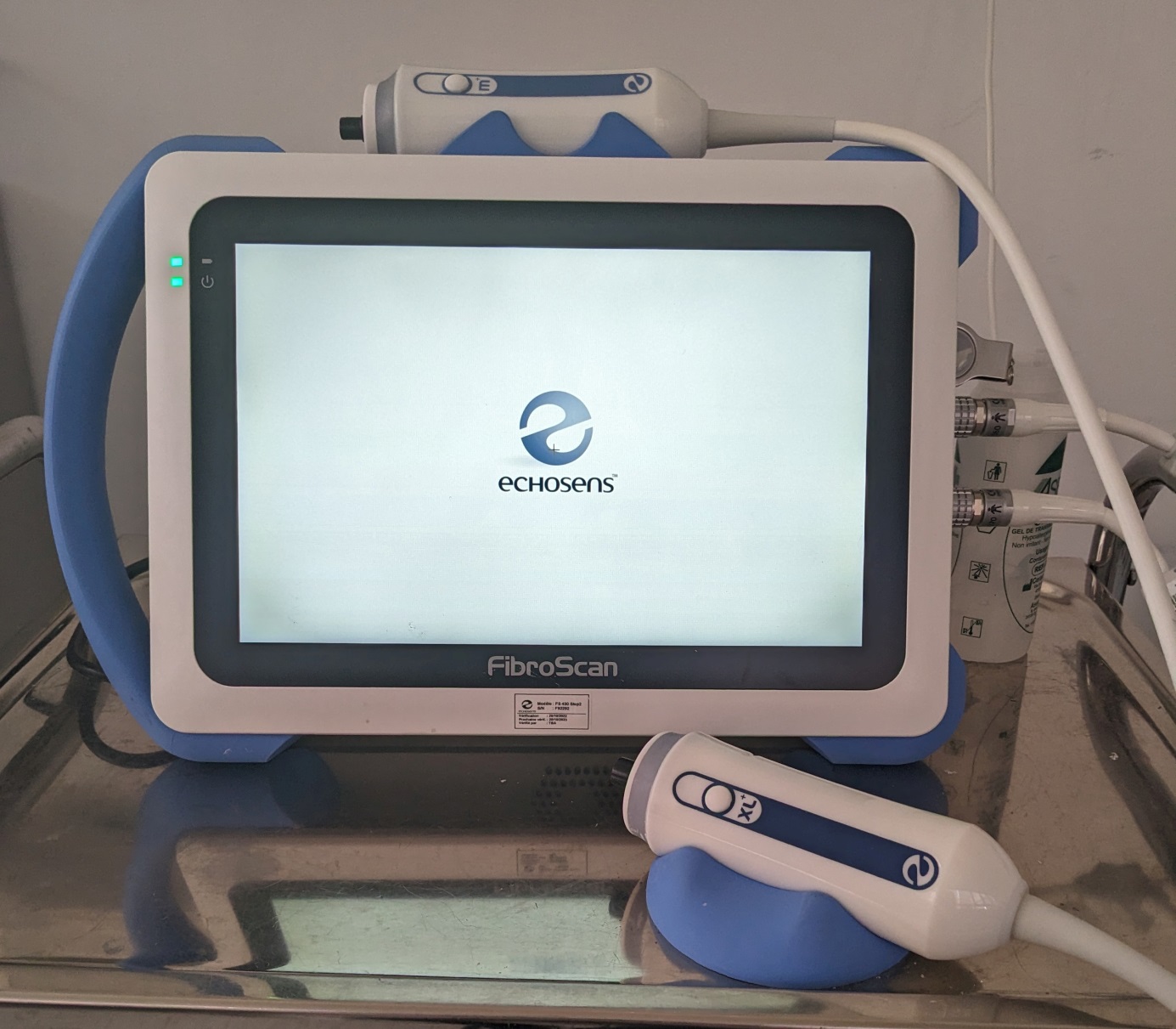 fibroscan